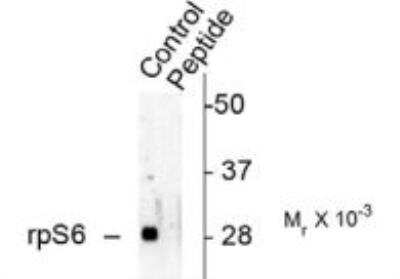 Western Blot: Ribosomal Protein S6/RPS6 [p Ser244] Antibody [NBP2-29653]